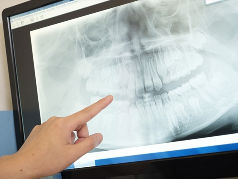 検査・治療計画の説明